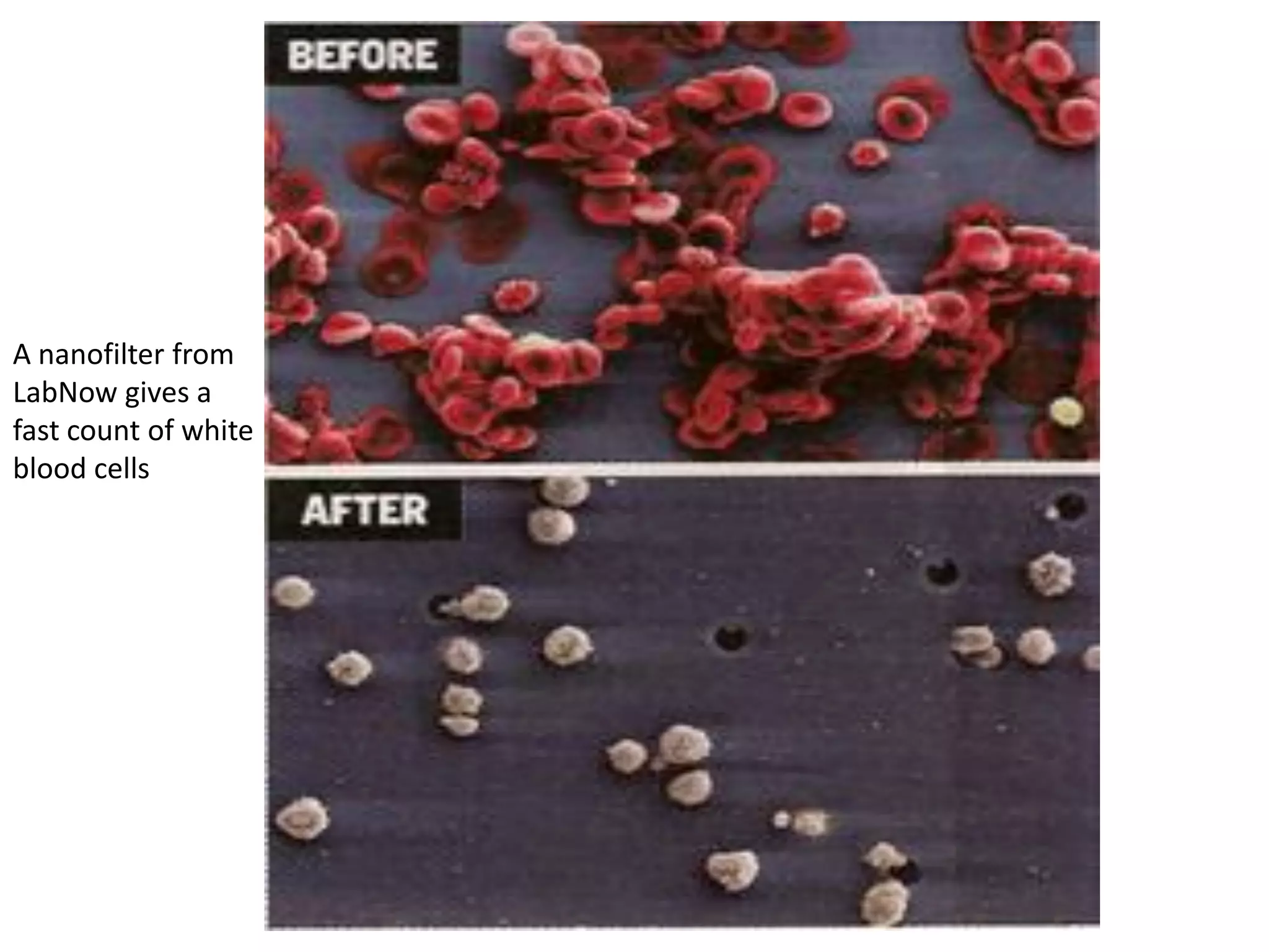A nanofilter from
LabNow gives a
fast count of white
blood cells
 