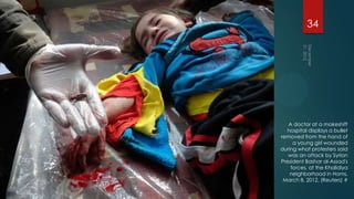 34




   A doctor at a makeshift
  hospital displays a bullet
removed from the hand of
     a young girl wounded
during what protesters said
   was an attack by Syrian
President Bashar al-Assad's
    forces, at the Khalidiya
    neighborhood in Homs,
 March 8, 2012. (Reuters) #
 