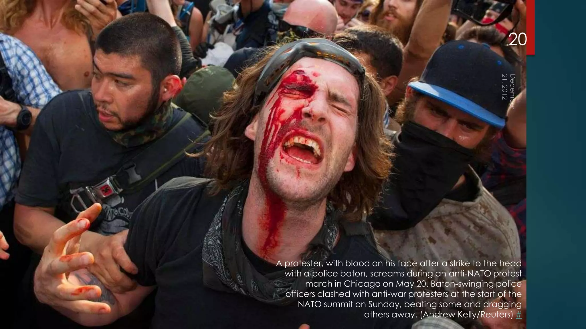 20




A protester, with blood on his face after a strike to the head
  with a police baton, screams during an anti-NATO protest
       march in Chicago on May 20. Baton-swinging police
  officers clashed with anti-war protesters at the start of the
      NATO summit on Sunday, beating some and dragging
                      others away. (Andrew Kelly/Reuters) #
 