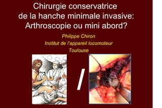 2013 025. Arthroscopie ou mini voie dans la chirurgie conservatrice de la hanche