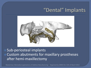  Sub-periostealimplants
 Custom abutments for maxillary prostheses
  after hemi-maxillectomy
 Masterclass: Biomedical applications of Additive Manufacturing   Organized by SIRRIS the 12th of March 2013
 