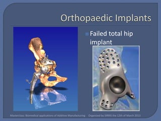  Failed   total hip
                                                                  implant




Masterclass: Biomedical applications of Additive Manufacturing   Organized by SIRRIS the 12th of March 2013
 