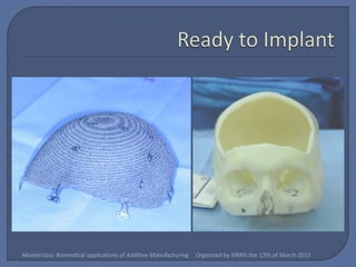 Masterclass: Biomedical applications of Additive Manufacturing   Organized by SIRRIS the 12th of March 2013
 