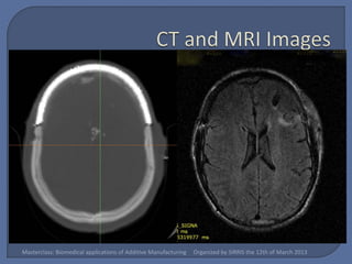 Masterclass: Biomedical applications of Additive Manufacturing   Organized by SIRRIS the 12th of March 2013
 