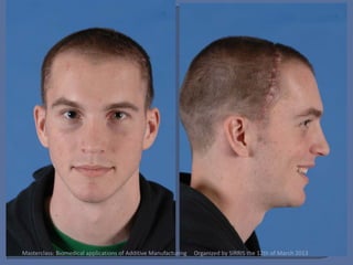 Masterclass: Biomedical applications of Additive Manufacturing   Organized by SIRRIS the 12th of March 2013
 