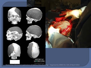 Masterclass: Biomedical applications of Additive Manufacturing   Organized by SIRRIS the 12th of March 2013
 