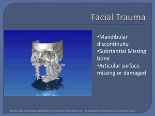 •Mandibular
                                                                           discontinuity
                                                                           •Substantial Missing
                                                                           bone
                                                                           •Articular surface
                                                                           missing or damaged




Masterclass: Biomedical applications of Additive Manufacturing   Organized by SIRRIS the 12th of March 2013
 