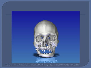 Masterclass: Biomedical applications of Additive Manufacturing   Organized by SIRRIS the 12th of March 2013
 