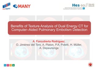 Benefits of Texture Analysis of Dual Energy CT for
Computer–Aided Pulmonary Embolism Detection
A. Foncubierta Rodríguez,
O. Jiménez del Toro, A. Platon, P.A. Poletti, H. Müller,
A. Depeursinge
 