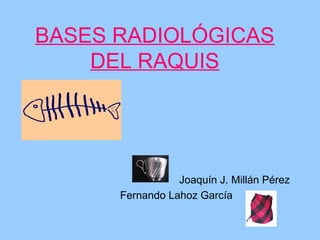 BASES RADIOLÓGICAS
DEL RAQUIS
Joaquín J. Millán Pérez
Fernando Lahoz García
 