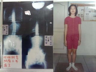 2013 09-28 玉玲-脊椎與健康