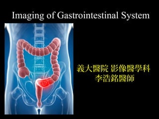 1
Imaging of Gastrointestinal System
義大醫院 影像醫學科
李浩銘醫師
 