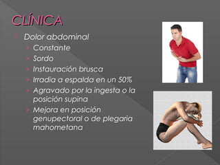 CLÍNICA


Dolor abdominal
› Constante
› Sordo
› Instauración brusca
› Irradia a espalda en un 50%
› Agravado por la ingesta o la

posición supina
› Mejora en posición
genupectoral o de plegaria
mahometana

 