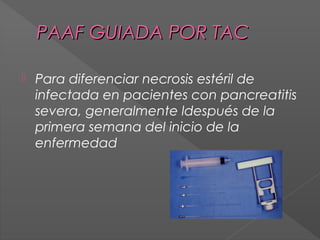 PAAF GUIADA POR TAC


Para diferenciar necrosis estéril de
infectada en pacientes con pancreatitis
severa, generalmente ldespués de la
primera semana del inicio de la
enfermedad

 