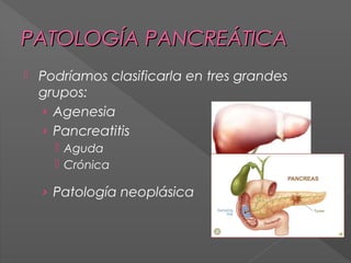 PATOLOGÍA PANCREÁTICA


Podríamos clasificarla en tres grandes
grupos:
› Agenesia
› Pancreatitis
 Aguda
 Crónica

› Patología neoplásica

 