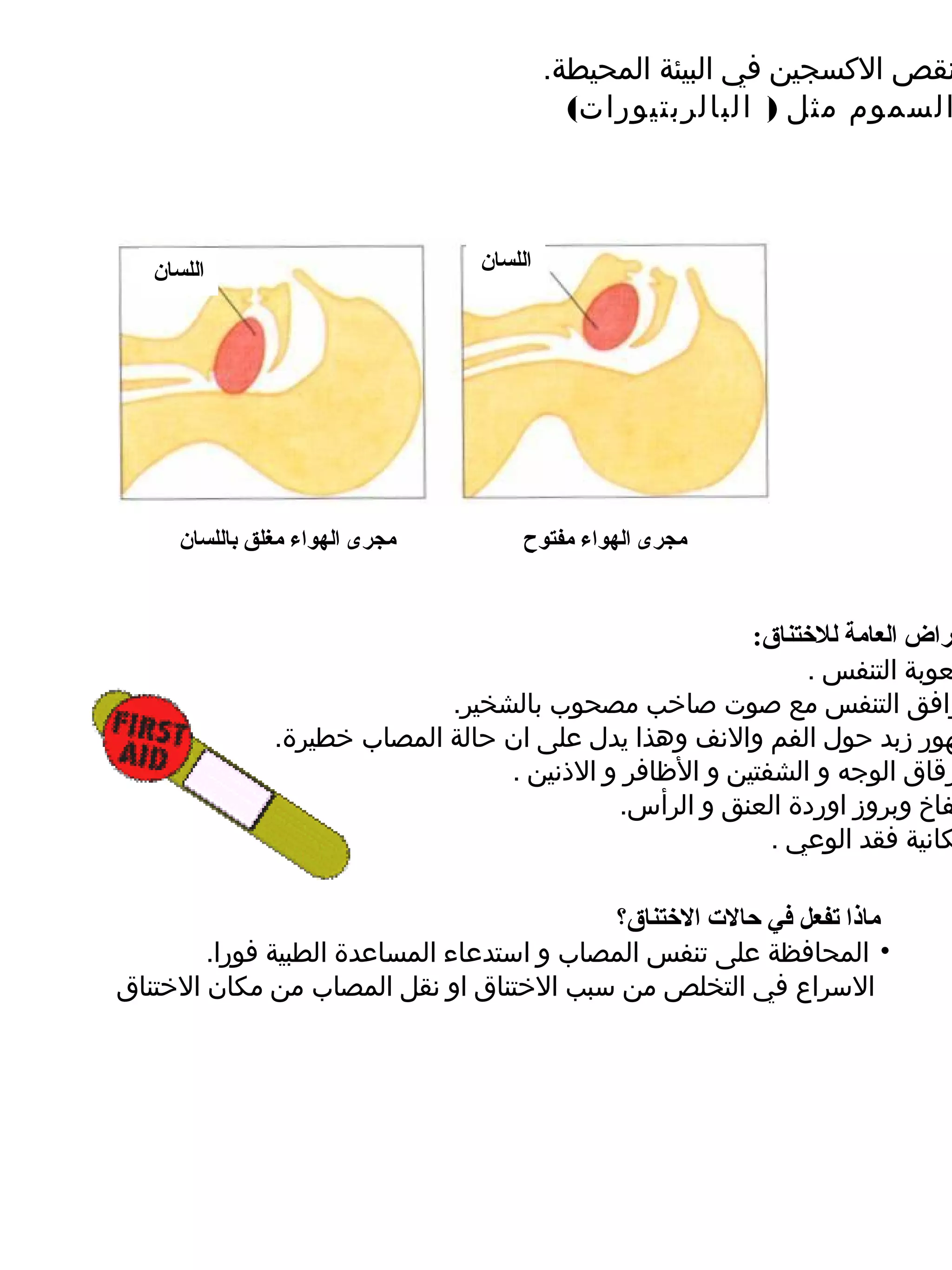 ‫نقص الكسجين في البيئة المحيطة.‬
                                             ‫السموم مثل ) البالربتيورات(‬




   ‫اللسان‬                         ‫اللسان‬




      ‫مجرى الهواء مغلق باللسان‬         ‫مجرى الهواء مفتوح‬


                                                         ‫راض العامة للتختناق:‬
                                                               ‫عوبة التنفس .‬
                              ‫رافق التنفس مع صوت صاخب مصحوب بالشخير.‬
                ‫هور زبد حول الفم والنف وهذا يدل ضعلى ان حالة المصاب خطيرة.‬
                                   ‫رقاق الوجه و الشفتين و الظافر و الذنين .‬
                                             ‫فاخ وبروز اوردة العنق و الرأس.‬
                                                           ‫كانية فقد الوضعي .‬

                                             ‫ماذا تفعل في حالت التختناق؟‬
        ‫• المحافظة ضعلى تنفس المصاب و استدضعاء المساضعدة الطبية فورا.‬
‫السراع في التخلص من سبب الختناق او نقل المصاب من مكان الختناق‬
 