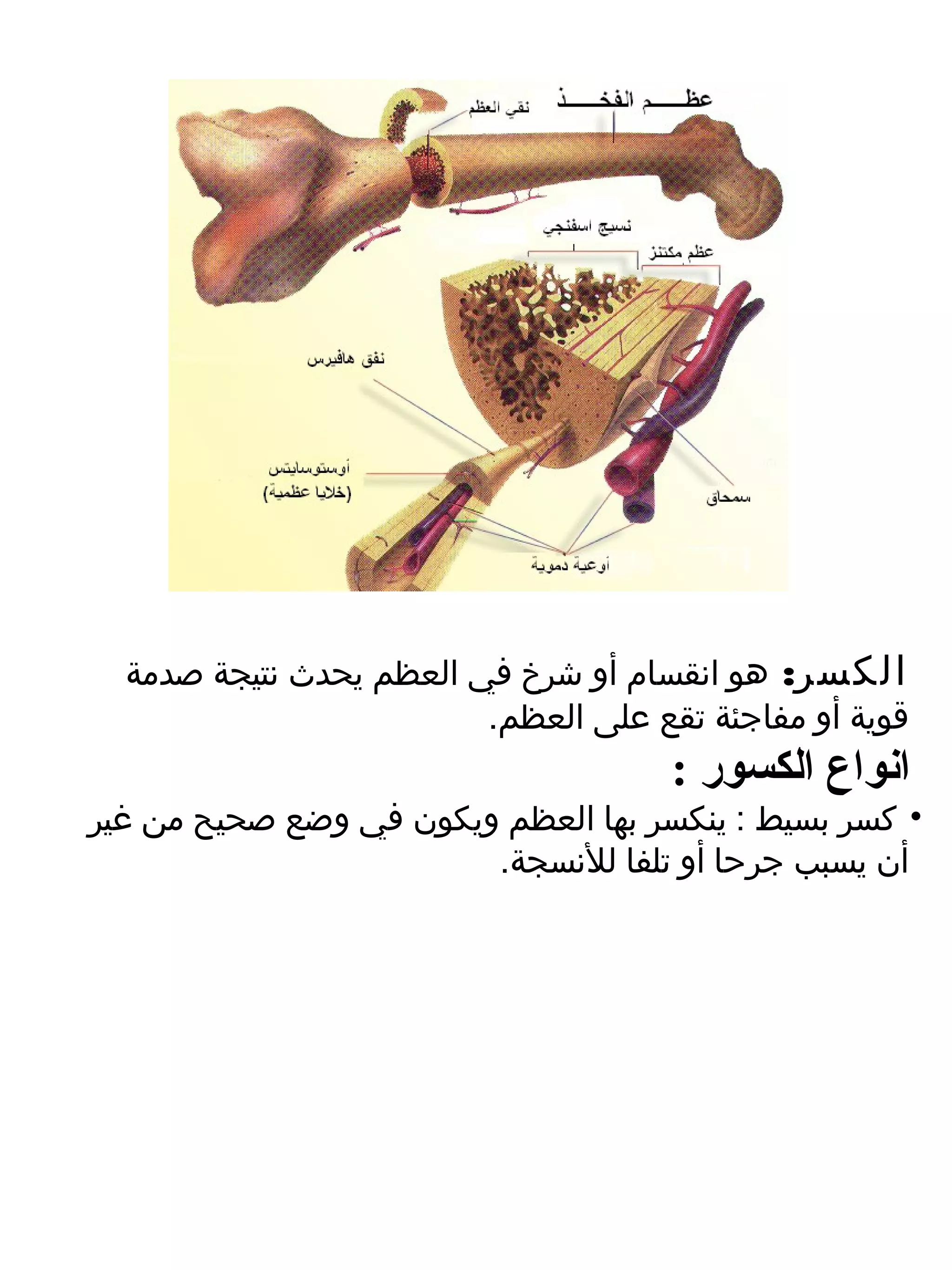 ‫الكسر: هو انقسام أو شرخ في العظم يحدث نتيجة صدمة‬
                         ‫قوية أو مفاجئة تقع على العظم.‬
                                      ‫انواع الكسور :‬
‫• كسر بسيط : ينكسر بها العظم ويكون في وضع صحيح م ن غير‬
                         ‫أن يسبب جرحا أو تلفا للنسجة.‬
 