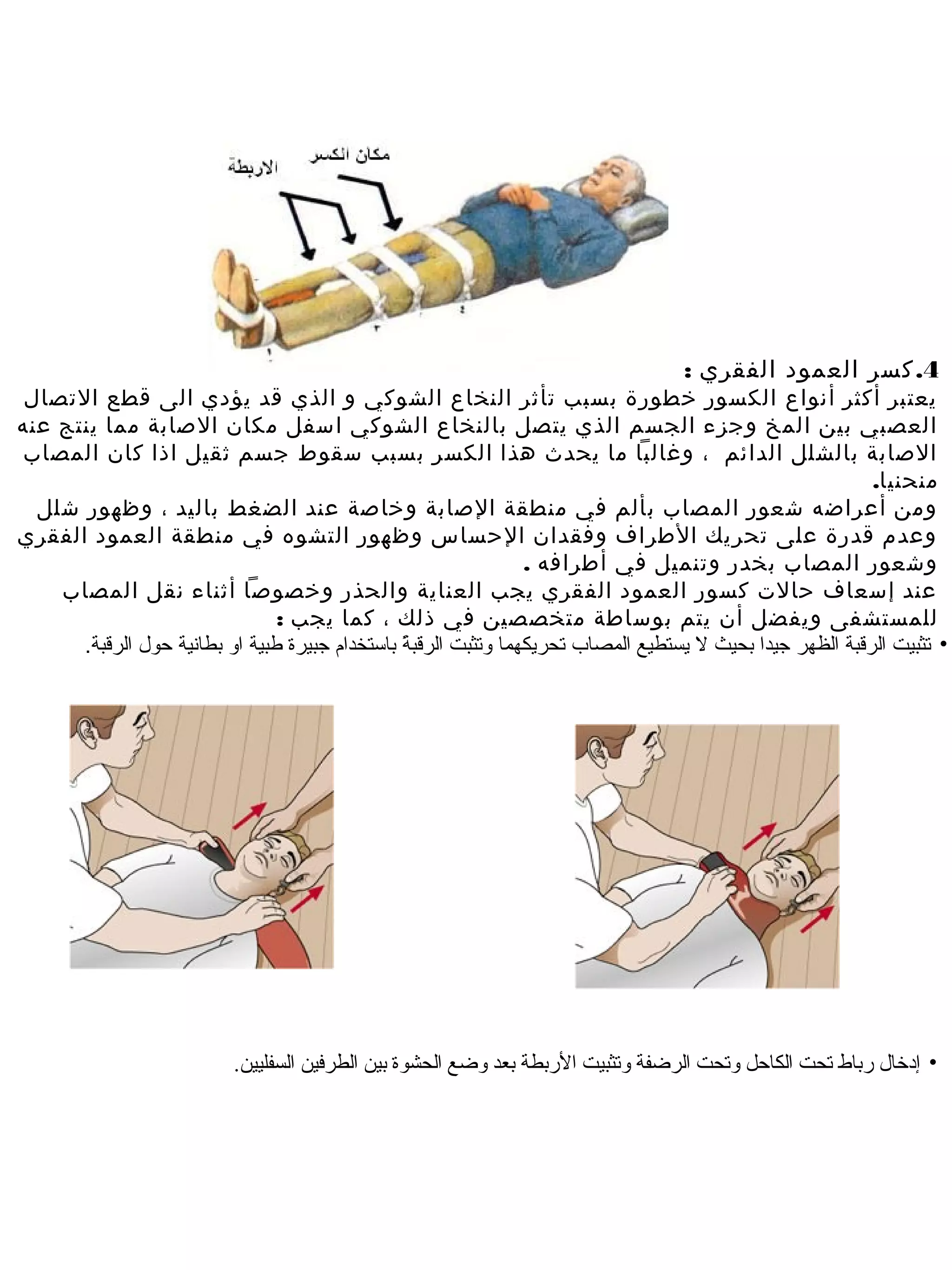 ‫4. كسر العمود الفقري :‬
 ‫يعتبر أكثر أنواع الكسور خطورة بسبب تأثر النخاع الشوكي و الذي قد يؤدي الى قطع التصال‬
‫العصبي بي ن المخ وجزء الجسم الذي يتصل بالنخاع الشوكي اسفل مكان الصابة مما ينتج عنه‬
‫الصابة بالشلل الدائم ، وغالبا ما يحدث هذا الكسر بسبب سقوط جسم ثقيل اذا كان المصاب‬
                                                                                                            ‫منحنيا.‬
  ‫وم ن أعراضه شعور المصاب بألم في منطقة الصابة وخاصة عند الضغط باليد ، وظهور شلل‬
‫وعدم قدرة على تحريك الطرا ف وفقدان الحساس وظهور التشوه في منطقة العمود الفقري‬
                                                                  ‫وشعور المصاب بخدر وتنميل في أطرافه .‬
    ‫عند إسعا ف حالت كسور العمود الفقري يجب العناية والحذر وخصوصا أثناء نقل المصاب‬
                                 ‫للمستشفى ويفضل أن يتم بوساطة متخصصي ن في ذلك ، كما يجب :‬
      ‫• تثبيت الرقبة الظهر جيدا بحيث ل يستطيع المصاب تحريكهما وتثبت الرقبة باستخدام جبيرة فطبية او بطاهنية حول الرقبة.‬
                                                  ‫ ً‬




                           ‫• إدخال رباط تحت الكاحل وتحت الرضفة وتثبيت الربطة بعد وضع الحشوة بين الطرفين السفليين.‬
 