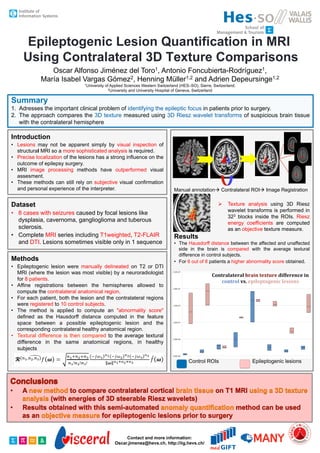 Epileptogenic Lesion Quantification in MRI
Using Contralateral 3D Texture Comparisons
1,
Toro

Oscar Alfonso Jiménez del
Antonio
2, Henning Müller1,2 and Adrien Depeursinge1,2
María Isabel Vargas Gómez
1University

1,
Foncubierta-Rodríguez

of Applied Sciences Western Switzerland (HES–SO), Sierre, Switzerland;
2University and University Hospital of Geneva, Switzerland

Summary
1.  Adresses the important clinical problem of identifying the epileptic focus in patients prior to surgery.
2.  The approach compares the 3D texture measured using 3D Riesz wavelet transforms of suspicious brain tissue
with the contralateral hemisphere

Introduction
•  Lesions may not be apparent simply by visual inspection of
structural MRI so a more sophisticated analysis is required.
•  Precise localization of the lesions has a strong influence on the
outcome of epilepsy surgery.
•  MRI image processing methods have outperformed visual
assesment.
•  These methods can still rely on subjective visual confirmation
and personal experience of the interpreter.

Manual annotation Contralateral ROI Image Registration

Dataset
•  8 cases with seizures caused by focal lesions like
dysplasia, cavernoma, ganglioglioma and tuberous
sclerosis.
•  Complete MRI series including T1weighted, T2-FLAIR
and DTI. Lesions sometimes visible only in 1 sequence

Methods
•  Epileptogenic lesion were manually delineated on T2 or DTI
MRI (where the lesion was most visible) by a neuroradiologist
for 8 patients.
•  Affine registrations between the hemispheres allowed to
compute the contralateral anatomical region.
•  For each patient, both the lesion and the contralateral regions
were registered to 10 control subjects.
•  The method is applied to compute an "abnormality score"
defined as the Hausdorff distance computed in the feature
space between a possible epileptogenic lesion and the
corresponding contralateral healthy anatomical region.
•  Textural difference is then compared to the average textural
difference in the same anatomical regions, in healthy
subjects

  Texture analysis using 3D Riesz
wavelet transforms is performed in
323 blocks inside the ROIs. Riesz
energy coefficients are computed
as an objective texture measure.

Results
•  The Hausdorff distance between the affected and unaffected
side in the brain is compared with the average textural
difference in control subjects.
•  For 6 out of 8 patients a higher abnormality score obtained.

Control ROIs

Contact and more information:
Oscar.jimenez@hevs.ch, http://iig.hevs.ch/

Epileptogenic lesions

 