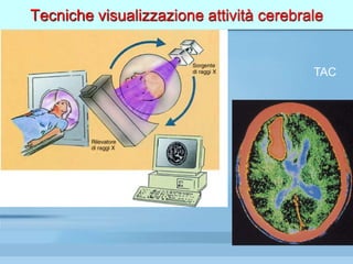 Tecniche visualizzazione attività cerebrale
TAC
 