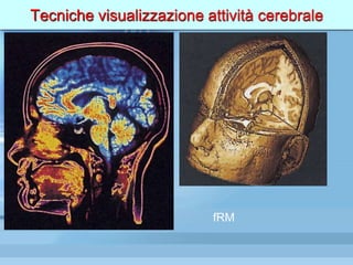Tecniche visualizzazione attività cerebrale
fRM
 