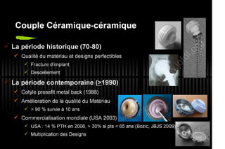 2013 032. Douleur sur PTH céramique-céramique