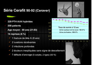 2013 032. Douleur sur PTH céramique-céramique
