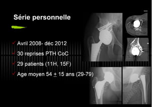 2013 032. Douleur sur PTH céramique-céramique