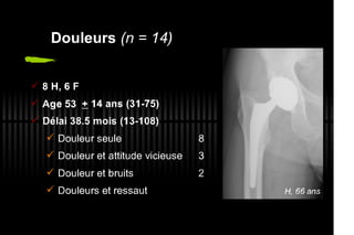 2013 032. Douleur sur PTH céramique-céramique