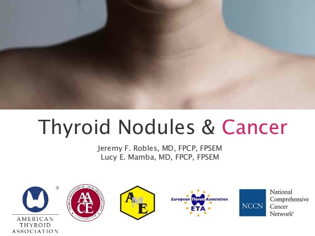 2013 414 CDO TEPI thyroid nodules and cancer (Case