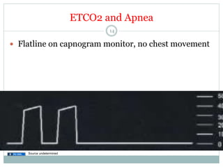 ETCO2 and Apnea
14

—  Flatline on capnogram monitor, no chest movement

Source undetermined

 
