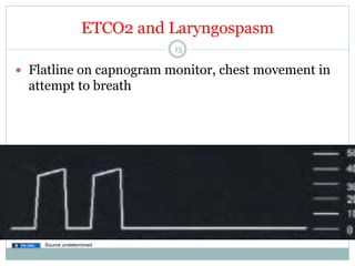 ETCO2 and Laryngospasm
15

—  Flatline on capnogram monitor, chest movement in

attempt to breath

Source undetermined

 