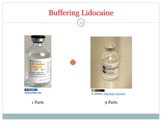 Buffering Lidocaine
23

Clinbiochem.info

1 Parts

JL Johnson, Wikimedia Commons

9 Parts

 