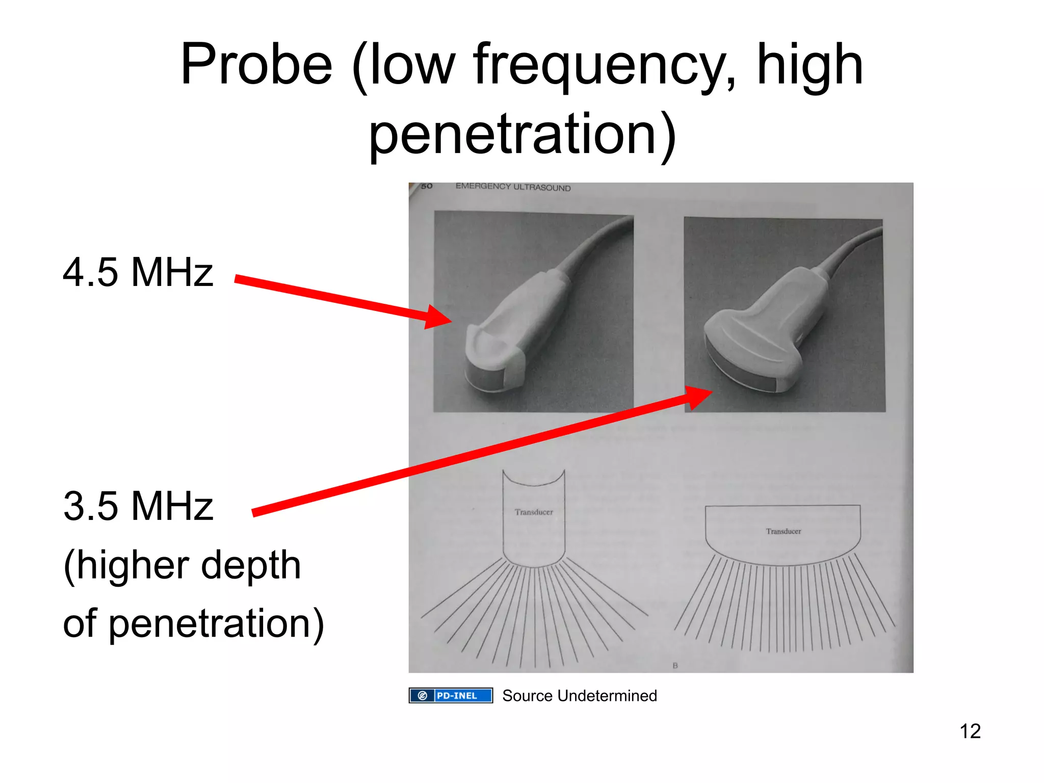 Probe (low frequency, high penetration) 
4.5 MHz 
3.5 MHz 
(higher depth 
of penetration) 
12 
Source Undetermined  