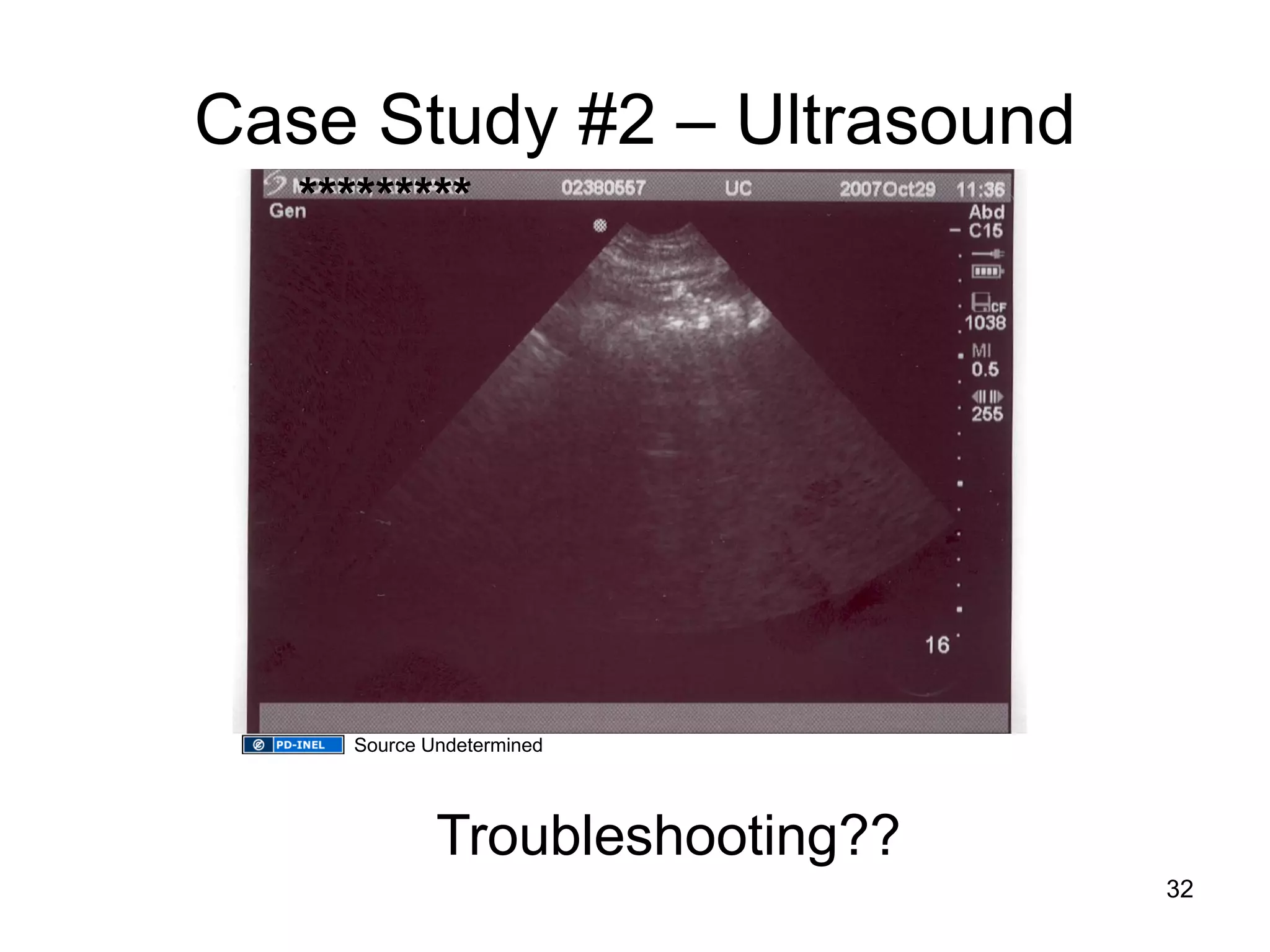 Case Study #2 – Ultrasound 
Troubleshooting?? 
********* 
32 
Source Undetermined  