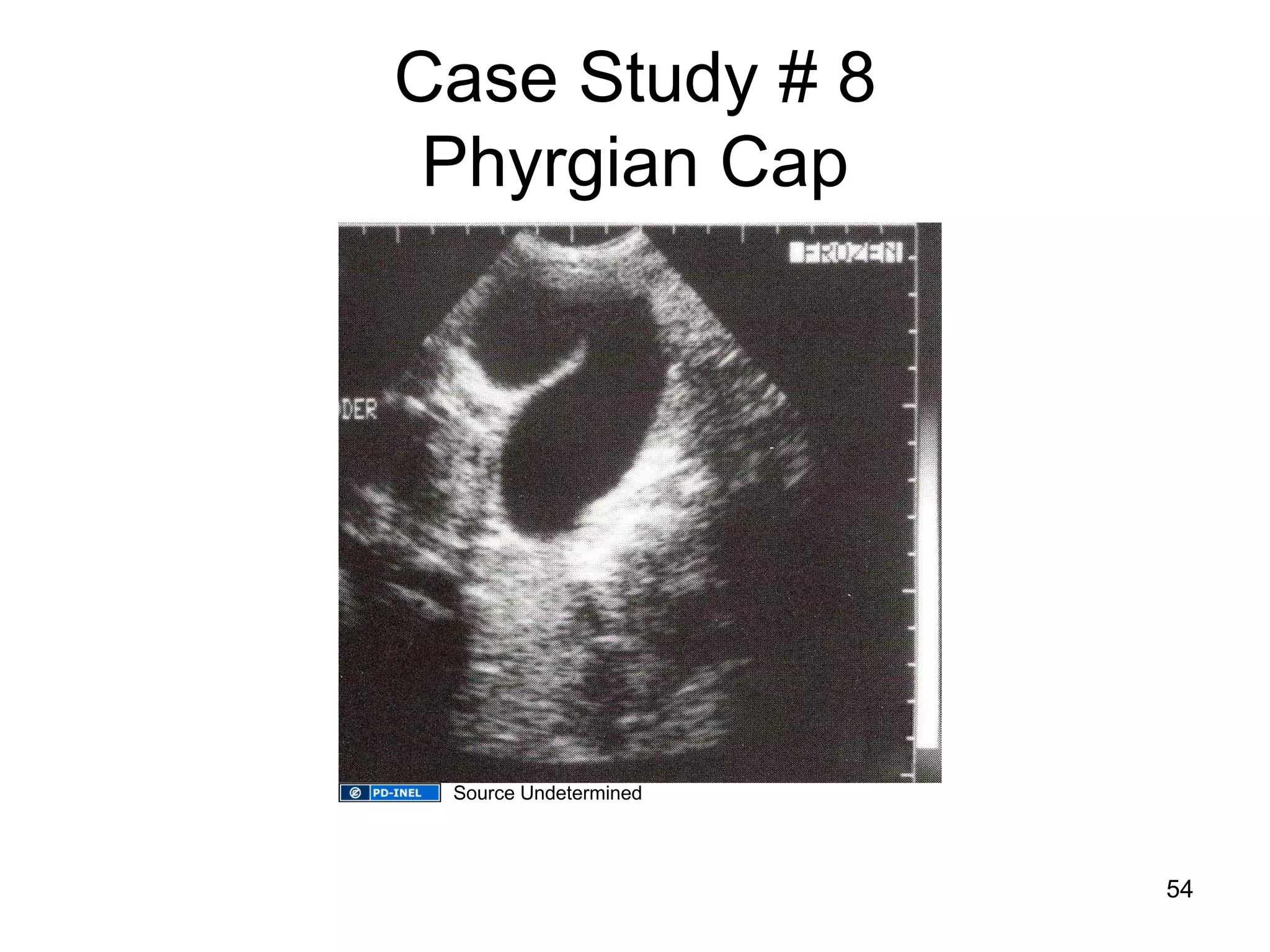 Case Study # 8 Phyrgian Cap 
54 
Source Undetermined  