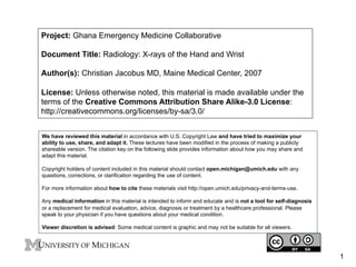 Project: Ghana Emergency Medicine Collaborative
Document Title: Radiology: X-rays of the Hand and Wrist
Author(s): Christian Jacobus MD, Maine Medical Center, 2007
License: Unless otherwise noted, this material is made available under the
terms of the Creative Commons Attribution Share Alike-3.0 License:
http://creativecommons.org/licenses/by-sa/3.0/
We have reviewed this material in accordance with U.S. Copyright Law and have tried to maximize your
ability to use, share, and adapt it. These lectures have been modified in the process of making a publicly
shareable version. The citation key on the following slide provides information about how you may share and
adapt this material.
Copyright holders of content included in this material should contact open.michigan@umich.edu with any
questions, corrections, or clarification regarding the use of content.
For more information about how to cite these materials visit http://open.umich.edu/privacy-and-terms-use.
Any medical information in this material is intended to inform and educate and is not a tool for self-diagnosis
or a replacement for medical evaluation, advice, diagnosis or treatment by a healthcare professional. Please
speak to your physician if you have questions about your medical condition.
Viewer discretion is advised: Some medical content is graphic and may not be suitable for all viewers.

1

 