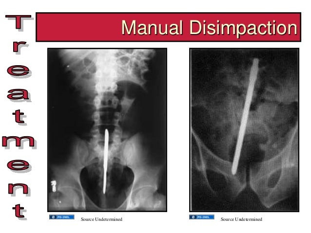 GEMC- The Adult Patient with Constipation- Resident Training