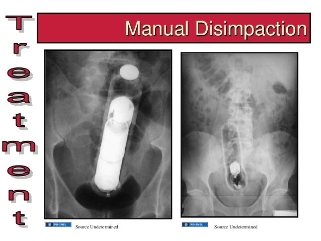 GEMC- The Adult Patient with Constipation- Resident Training