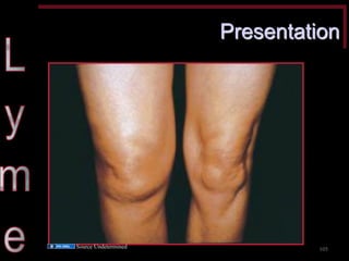 Presentation 
105 
Source Undetermined  