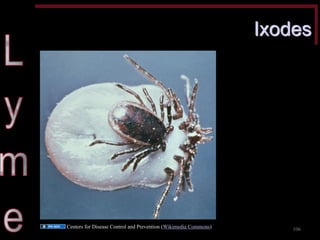 Ixodes 
106 
Centers for Disease Control and Prevention (Wikimedia Commons)  
