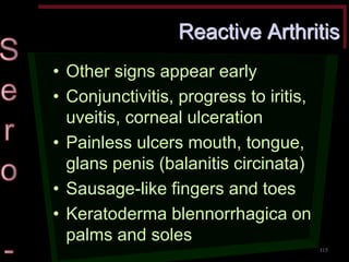 Reactive Arthritis •Other signs appear early •Conjunctivitis, progress to iritis, uveitis, corneal ulceration •Painless ulcers mouth, tongue, glans penis (balanitis circinata) •Sausage-like fingers and toes •Keratoderma blennorrhagica on palms and soles 
115  