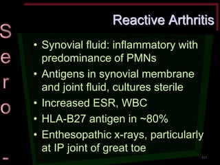 Reactive Arthritis •Synovial fluid: inflammatory with predominance of PMNs •Antigens in synovial membrane and joint fluid, cultures sterile •Increased ESR, WBC •HLA-B27 antigen in ~80% •Enthesopathic x-rays, particularly at IP joint of great toe 
117  