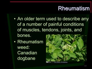 Rheumatism •An older term used to describe any of a number of painful conditions of muscles, tendons, joints, and bones. 
•Rheumatism weed: Canadian dogbane 
123 
SB Johnny (Wikipedia)  