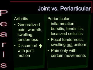 Joint vs. Periarticular Arthritis •Generalized pain, warmth, swelling, tenderness •Discomfort  with joint motion Periarticular inflammation: bursitis, tendinitis, localized cellulitis •Focal tenderness, swelling not uniform •Pain only with certain movements 
16  