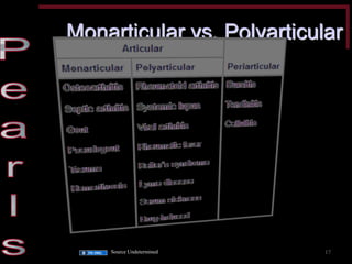 Monarticular vs. Polyarticular 
Source Undetermined 
17  