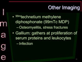 Other Imaging •99mtechnetium methylene diphosphonate (99mTc MDP) –Osteomyelitis, stress fractures •Gallium: gathers at proliferation of serum proteins and leukocytes –Infection 
34  