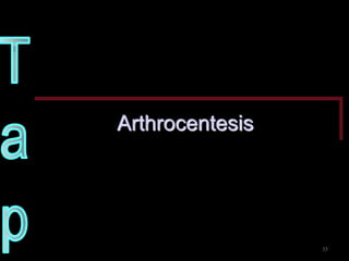 Arthrocentesis 
35  