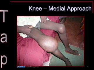 Knee – Medial Approach 
46 
Source Undetermined  