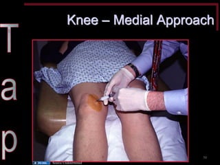 Knee – Medial Approach 
50 
Source Undetermined  
